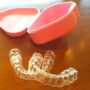 【韓国】歯列矯正の器具が外れました→リテーナーを購入へ